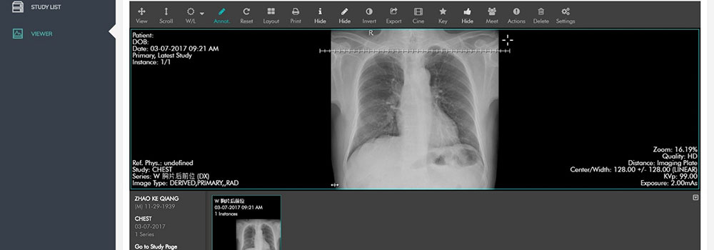 Medical-Image-Cloud-Storage-on-ExpertView