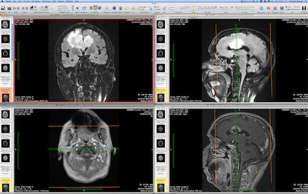 DICOM viewer iOS