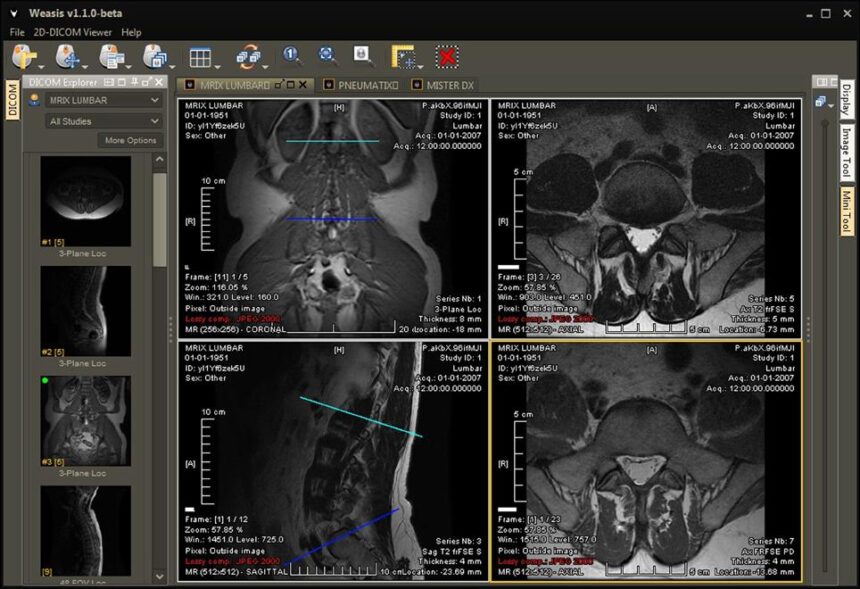HTML5 DICOM viewer open source