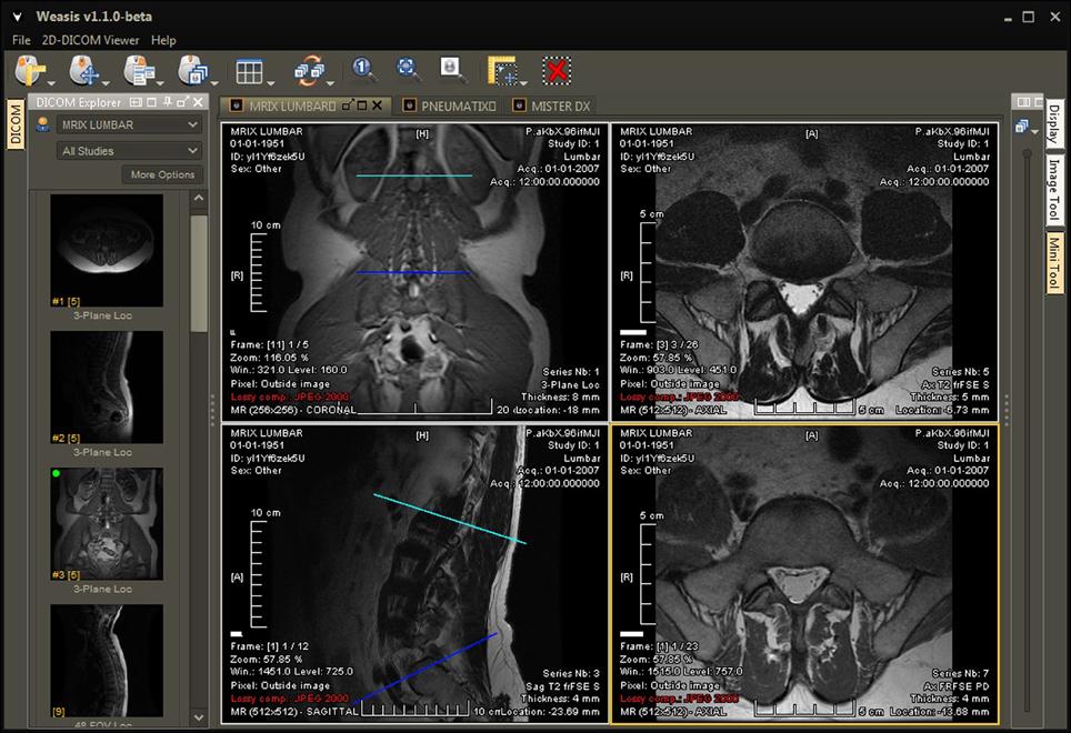 HTML5 DICOM viewer open source